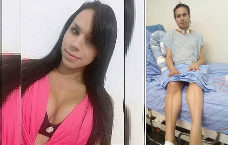 Babi sofreu uma tentativa de homicídio, no início do mês de abril, cometido pelo companheiro Domingos Mendes, o qual a transexual mantinha uma relação amorosa, no município de Presidente Dutra. (Divulgação)
