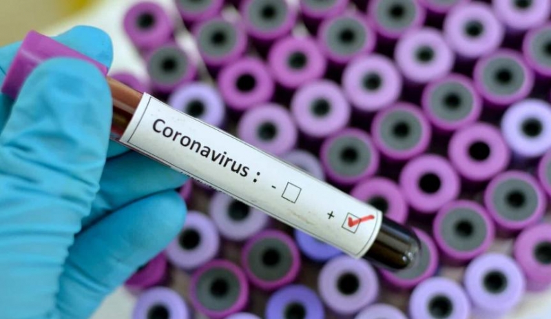 Segundo caso de coronavírus confirmado em Itapebi. (Imagem ilustrativa)