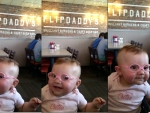 Bebê enxerga com nitidez pela primeira vez em vídeo emocionante